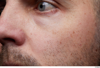  HD Face Skin Raul Conley cheek face nose skin pores skin texture 0002.jpg